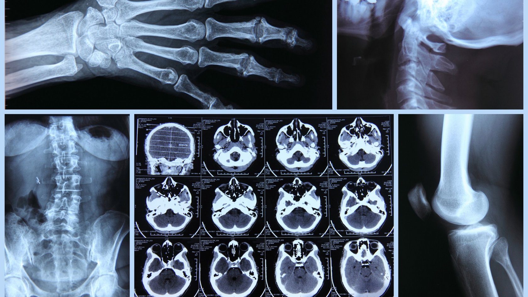 Eine Röntgenaufnahme
