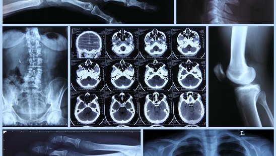 Eine Röntgenaufnahme