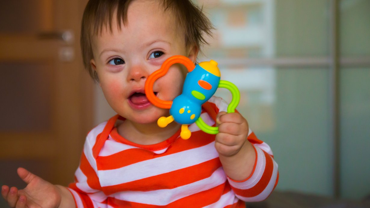 Kind mit Down Syndrome