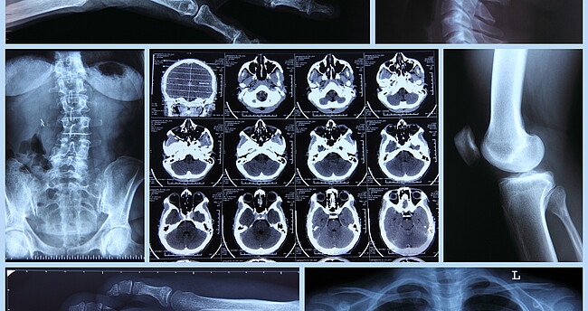 Röntgenaufnahmen