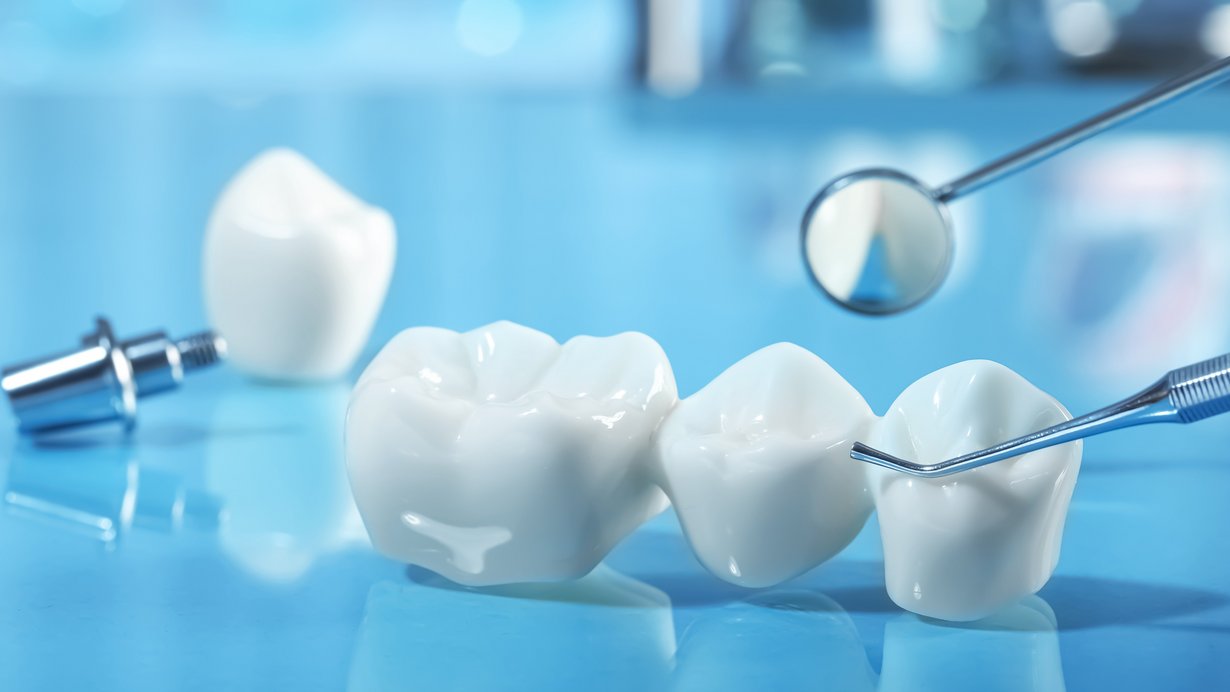 Bild zeigt Zahnkronen vor Zahnarztbesteck