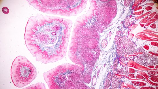 Menschliches Gewebe unter dem Mikroskop